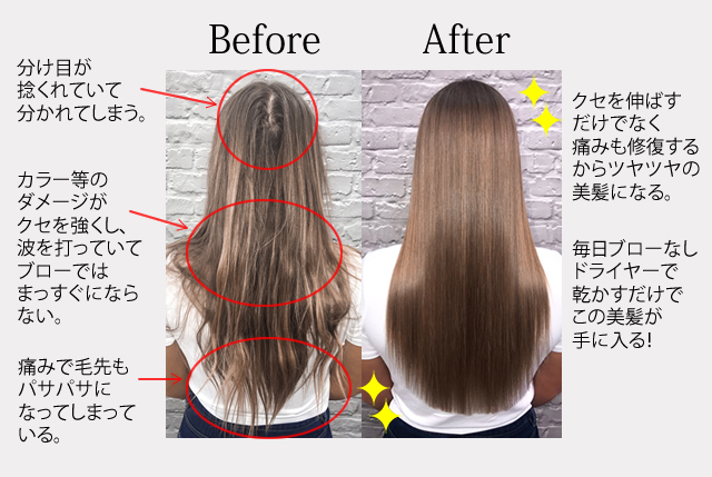 beforeafter